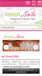 Mobile Screenshot of implantandsmile.com